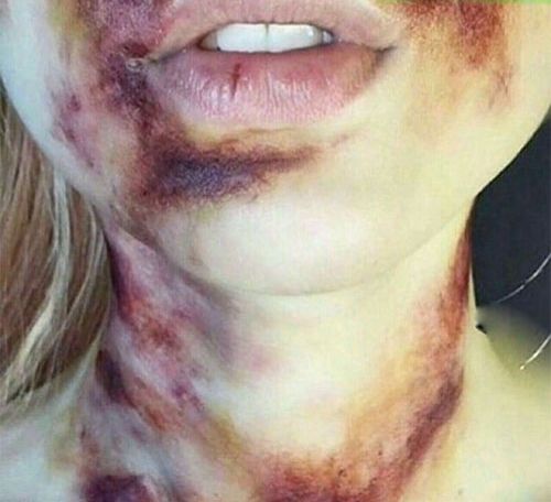 روزجهانی خشونت علیه زنان