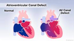 بیماری قلبی مادرزادی: 1. داستان یک زندگی کوتاه