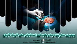 جراحی اصلاح استخوان های گوش میانی یا اسیکولوپلاستی