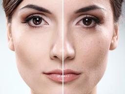 پاکسازی پوست چیست؟