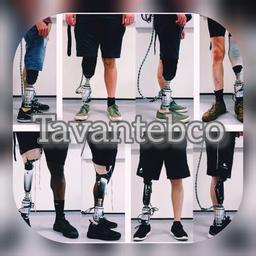 گزینه های پروتز و ارتز برای قطع اندام تحتانی و بازسازی