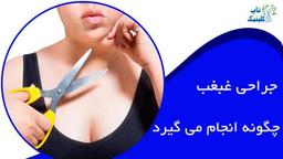 جراحی غبغب چگونه انجام می گیرد؟