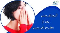 آبریزش بینی پس از جراحی بینی