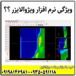 اتمام اندازه گیری خودکار در ویژوالایزر