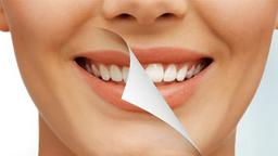 بلیچینگ یا سفید کردن دندان ها چیست؟
