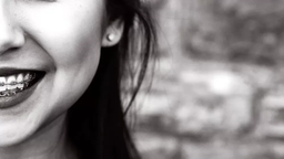 هزینه ارتودنسی به چه صورت حساب می‌شود؟