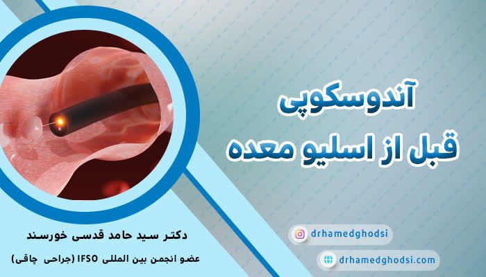 آندوسکوپی قبل از عمل اسلیو معده: ضرورت و مراحل