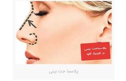 پلاسماجت بینی