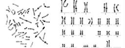 کاریوتایپ ( karyotype )