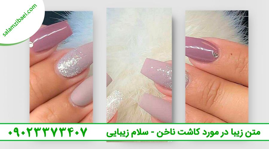 متن زیبا در مورد کاشت ناخن