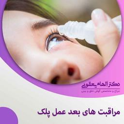 مهمترین کارهایی که باید بعد از عمل پلک کرد؟